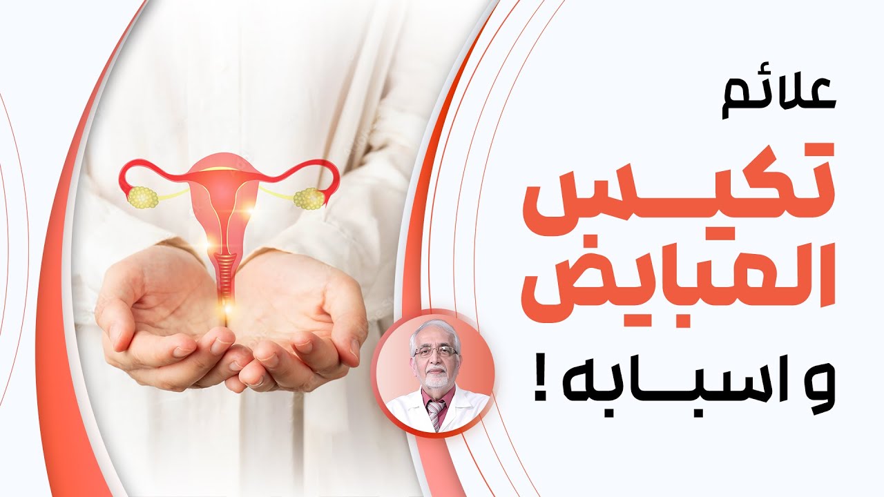 تكيس المبايض : شرح مفصل عن تكيس المبايض من الدكتور محمد الكرماني