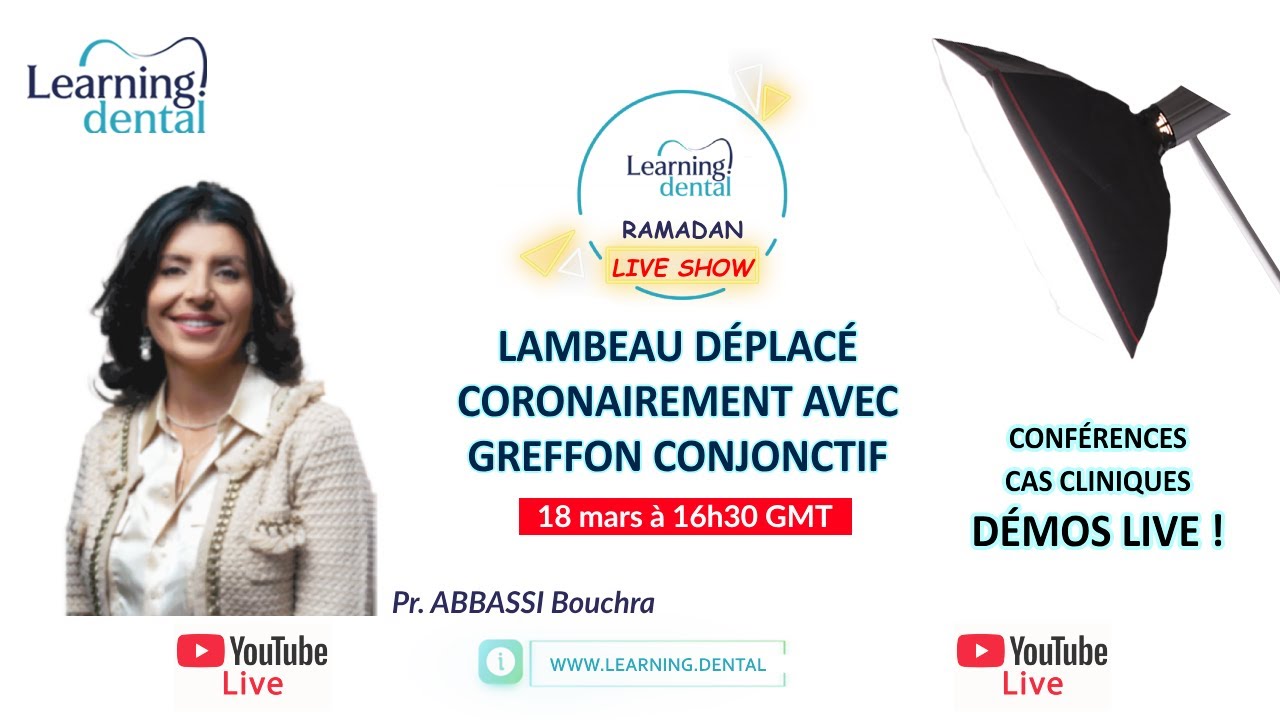 Aménagement tissulaire en Parodontologie: Greffe conjonctive enfouie et lambeau déplacé latéralement