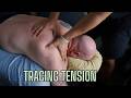 Scapular Tension Tracing | Why Lower Back Tightness Reaches the Shoulder