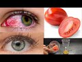 How to improve your eyesight naturally in 3 days / How to fix bad eyesight fast with Tomato orange