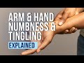 Arm and hand numbness and tingling explained