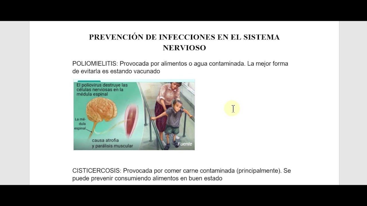 Prevención de infecciones en el Sistema nervioso CN sexto grado - YouTube