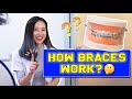 HOW Braces WORK? | #BraceYourself!🦷