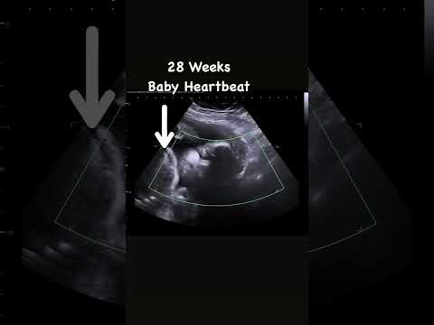 7 Months Baby