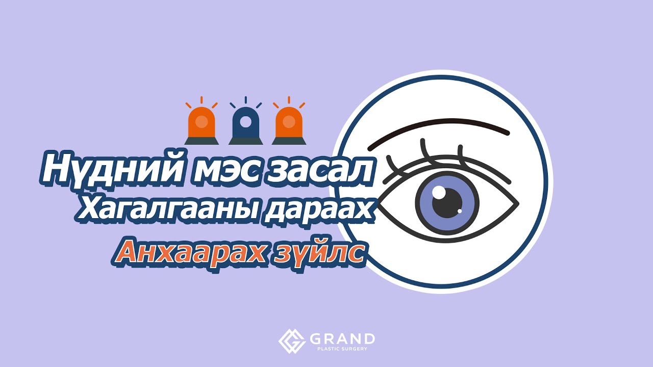 НҮДНИЙ МЭС ЗАСЛЫН ДАРААХ АНХААРАХ ЗҮЙЛС-ГРАНД ГОО САЙХНЫ ЭМНЭЛЭГ