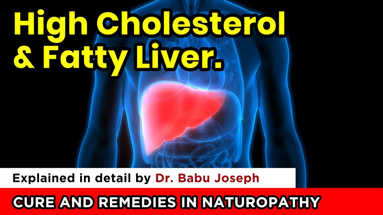 High Cholesterol l and Fatty Liver Cure and Remedies in Naturopathy