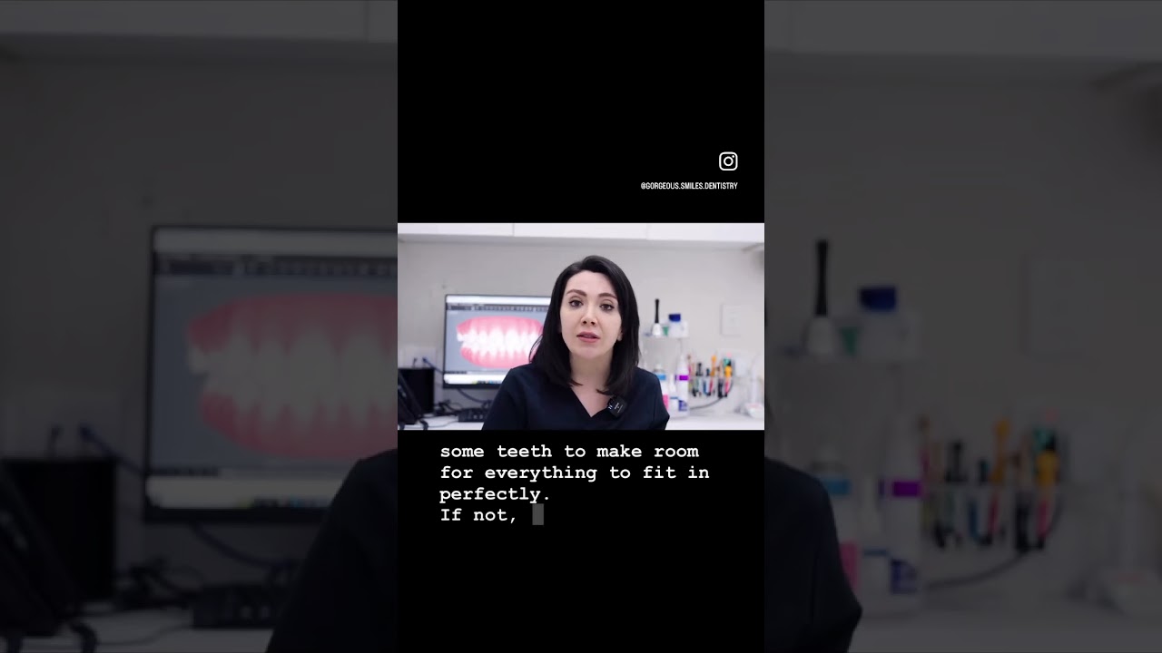 The Best Option For Perfect teeth.
at home Aligners or At the Dentist