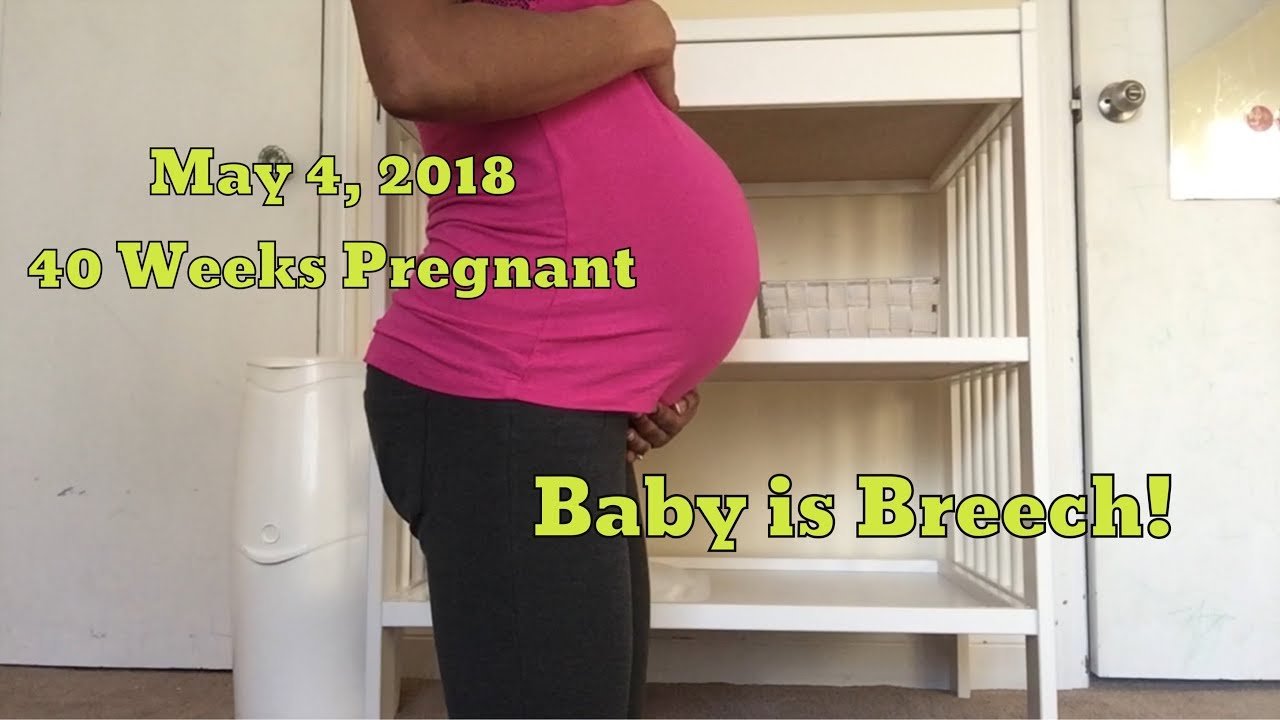 breech presentation at 40 weeks