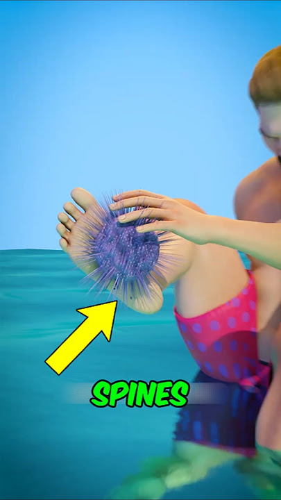 IF You Step on a Sea Urchin… WATCH This 😱‼️