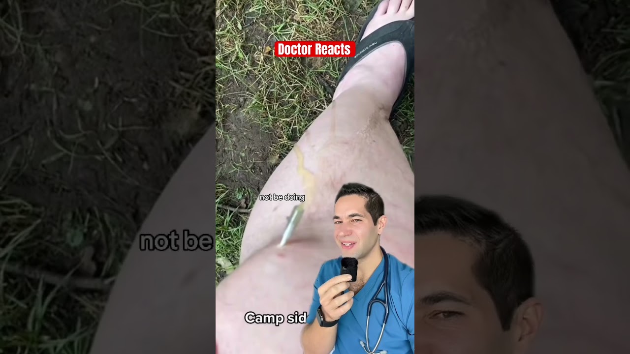 Реакция врача: протекает колено?!