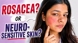 Do You Have Rosacea or a Damaged Skin Barrier? 5 Questions to Find Out