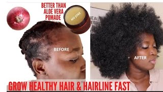 ONIONS 🌰 POMADE TO GROW YOUR BALDNESS ALOPECIA &amp; SLOW GROWTH 3 TIMES UNSTOPPABLE FASTER
