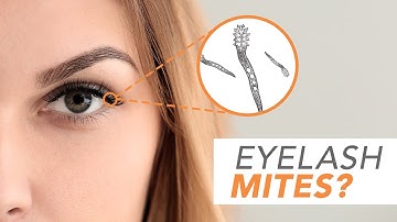 What are Demodex Mites? Optometrist Explains