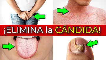 ¿Existe alguna relación entre los hongos de las uñas de los pies y el sistema inmunitario?