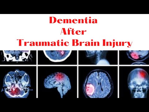 Dementia After Traumatic Brain Injury | Traumatic Brain Injuries | Brain Injuries