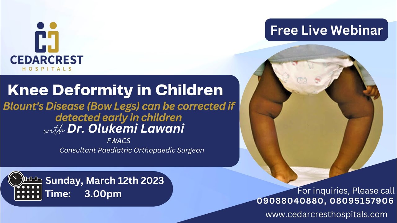 Webinar on Blount Disease in kids - YouTube