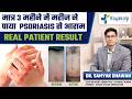 सिर्फ 3 महीने में Psoriasis हुआ जड़ से खत्म | Patient Case Study | Psoriasis Treatment India