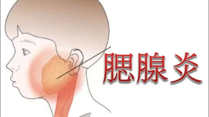 腮腺炎 - 天天要聞