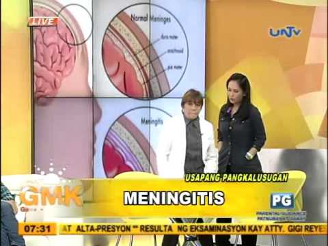 Vídeo: A meningite causa septicemia?