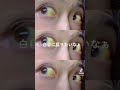 【黄疸】白目に戻りたいなぁ【閲覧注意】　#肝硬変　#黄疸