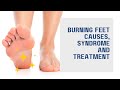 Burning Feet Causes, Syndrome and Treatment