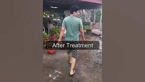 AVN Patient from jhansi | AVN Treatment without operation | Osteonecrosis | Dr. Vijay Prakash