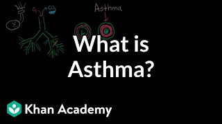 What is asthma? | Respiratory system diseases | NCLEX-RN | Khan Academy
