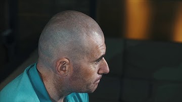 Robert Cookes Scalp Pigmentation makes him look 20 years younger