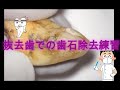 歯石取りの練習