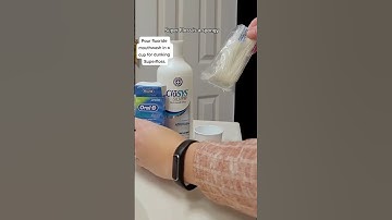 Hack for cavities between teeth - pediatric dentist approved! 🦷 Have you heard of super floss?