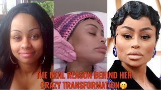 Blac Chyna's Plastic Surgery Rumors