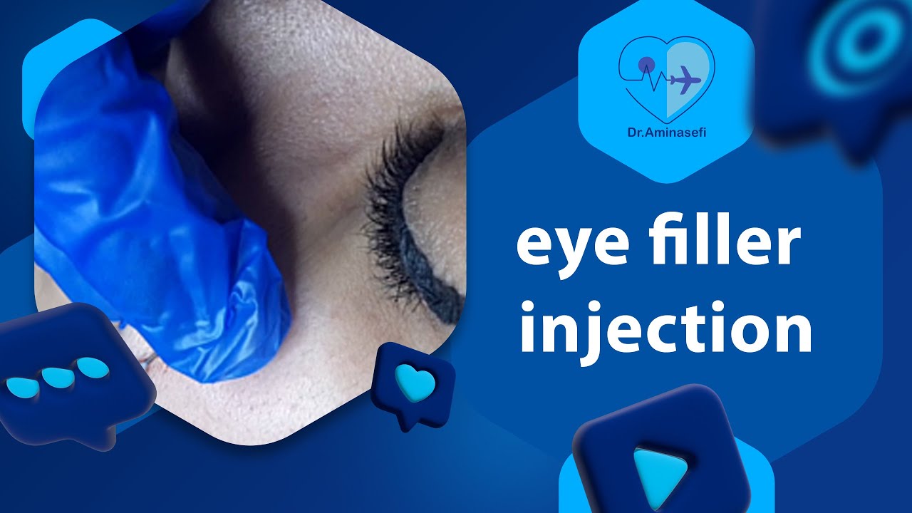 eye filler injection - YouTube