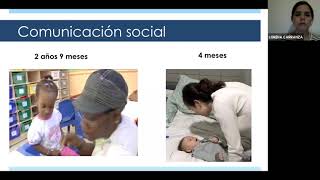 Diagnóstico Dual Síndrome de Down y Autismo