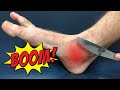 Fix Ankle Pain in 30 SECONDS With a Butter Knife