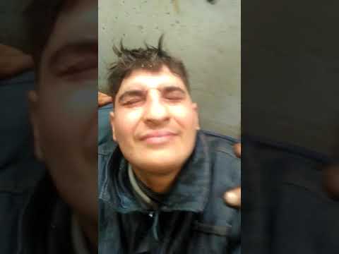 Gozu Kaynak Almasi Kaynak Alan Goz Tedavisi Gozu Kaynak Almasi Gozu Kaynak Almasi Tedavisi Kaynak Alan Goze Ne Iyi Gelir