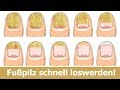 7 Hausmittel, mit denen du Nagelpilz in wenigen Tagen loswirst! | Ärzte sind erstaunt.