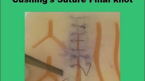(21) Cushing and Connell Sutures for lumen  repair