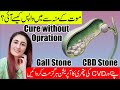 Gallbladder stones treatment homeopathic  gallbladder stones treatment without operation