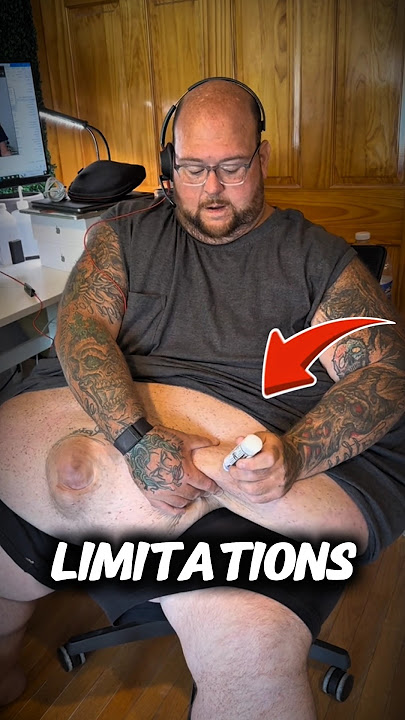 Never Let Yourself Become Obese‼️😰#shorts #fitness #obesity #gym