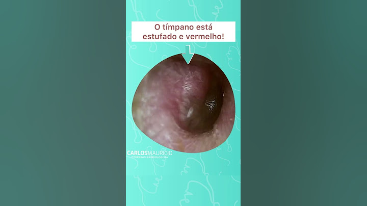 Cuidado ao assoar o nariz!