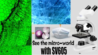SVBONY SV605 Microscope-observe the face mask and onion tissue