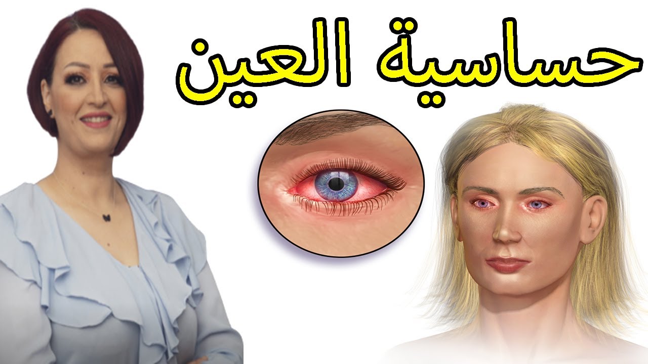 طرق حماية العين من حساسية العيون