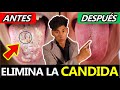COMO ELIMINAR LA CANDIDA EN EL ORGANISMO | GuiaMed