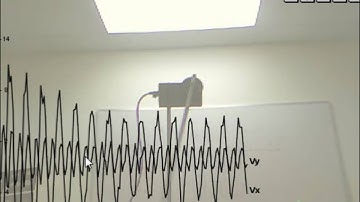 Project KTracker: Kinematic Analysis Using Kinect