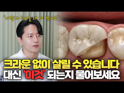 Ask for this instead of a crown | How to save your natural teeth