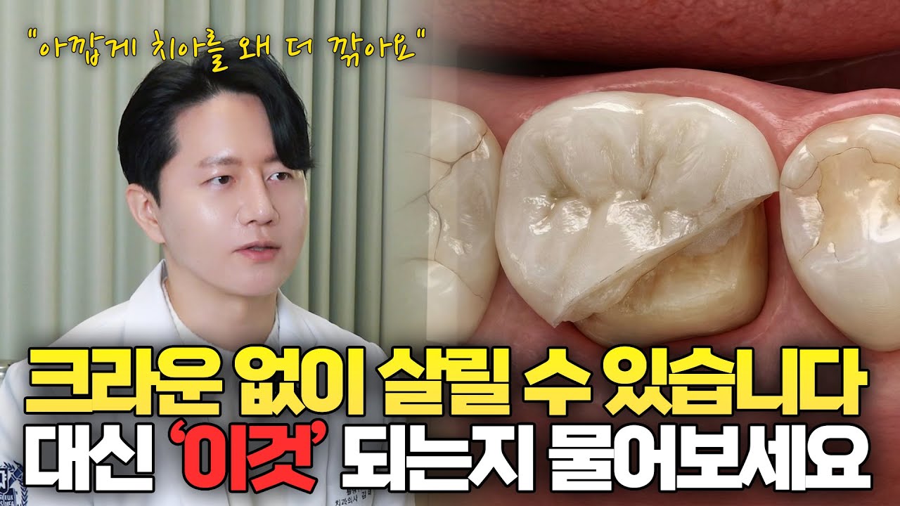 크라운 말고 이렇게 해달라고 하세요 | 자연치 보존하는 방법