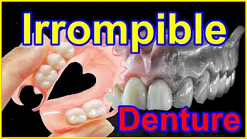 ¿Se puede conseguir una dentadura completa sin el paladar?