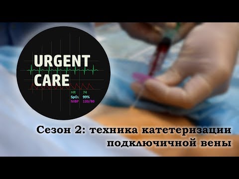 Техника катетеризации подключичной вены