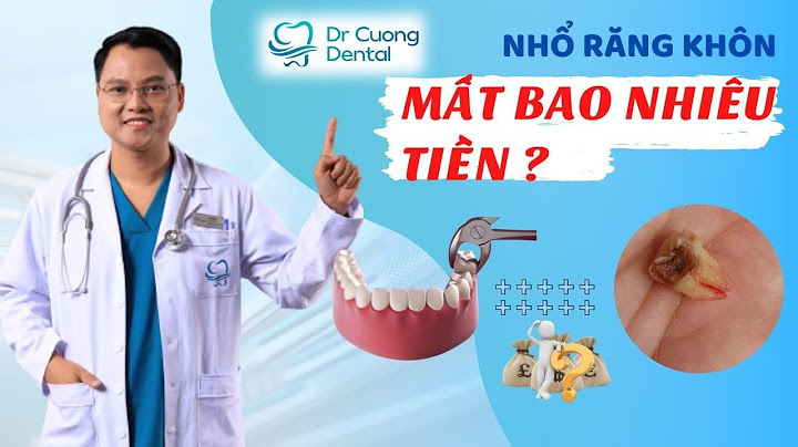 Nhổ răng hàm trên bao nhiêu tiền năm 2024