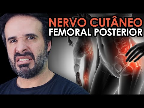 NERVO CUTÂNEO FEMORAL POSTERIOR: NESSA SITUAÇÃO ELE PODE SOFRER UMA COMPRESSÃO.